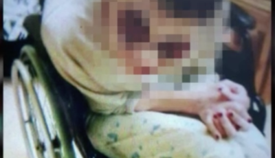 &Eacute;vek &oacute;ta verhetik &eacute;s al&aacute;zhatj&aacute;k a fogyat&eacute;koss&aacute;ggal &eacute;lőket egy veszpr&eacute;mi szoci&aacute;lis otthonban