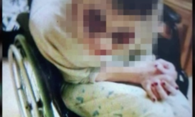 &Eacute;vek &oacute;ta verhetik &eacute;s al&aacute;zhatj&aacute;k a fogyat&eacute;koss&aacute;ggal &eacute;lőket egy veszpr&eacute;mi szoci&aacute;lis otthonban